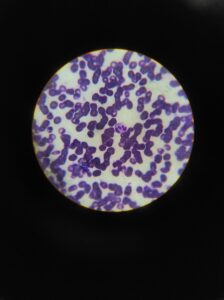 Rode bloedcellen onder de microscoop